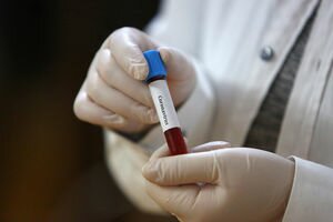 В Ивано-Франковске за день коронавирус обнаружили у 13 человек