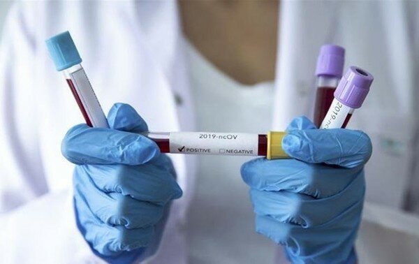 Первый случай коронавируса зафиксирован в Бразилии