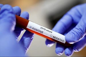 Появились детали о двух новых зараженных коронавирусом украинцах