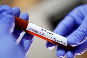 Из Китая пришли тесты на коронавирус, но воспользоваться ими нельзя