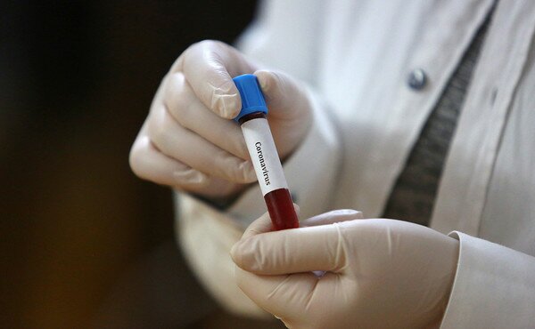 В Ивано-Франковске за день коронавирус обнаружили у 13 человек