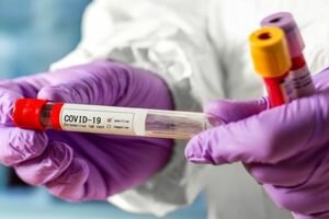 В Украине начнут тестировать переболевших COVID-19 на наличие антител к болезни