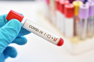Пандемия COVID-19: количество заболевших в мире коронавирусом уменьшается