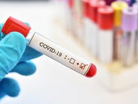 МОЗ обновило статистику заболевших коронавирусом по состоянию на 19 апреля