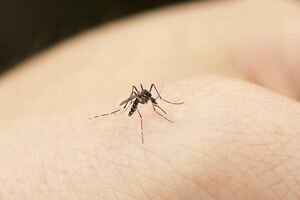 В Германии женщине ампутировали конечности из-за укуса комара