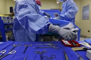 Спустя 25 лет: грузинские хирурги извлекли из живота пациентки пинцет