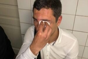 В Киеве лидера молодежного крыла партии Ляшко избили до сотрясения мозга