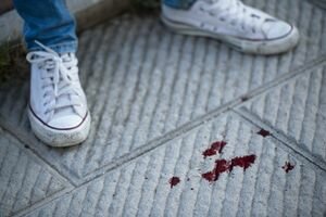 В Кировоградской области школьники жестоко избили одноклассника за проигрыш в эстафете